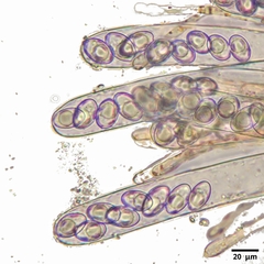Octospora gyalectoides
