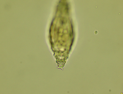 Bdelloidea