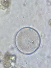 Coscinodiscophycidae