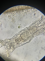 Philodina