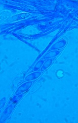 Hymenoscyphus laetus