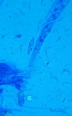 Hymenoscyphus laetus