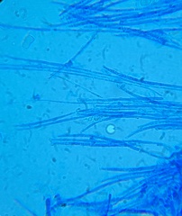 Hymenoscyphus laetus