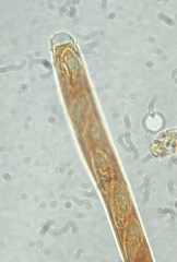 Hymenoscyphus laetus