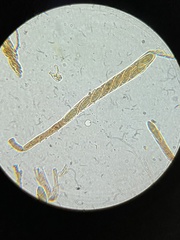 Hymenoscyphus laetus