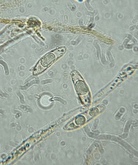 Hymenoscyphus laetus