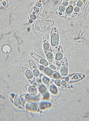 Hymenoscyphus laetus