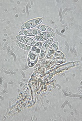 Hymenoscyphus laetus