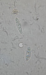 Hymenoscyphus laetus