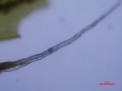 Grimmia trichophylla