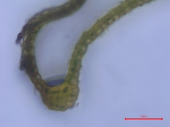 Grimmia trichophylla