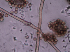 Lycoperdon dermoxanthum