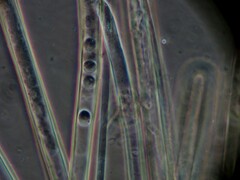 Wynnea americana