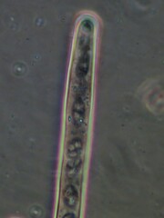 Wynnea americana