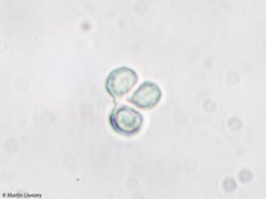 Multifurca ochricompacta