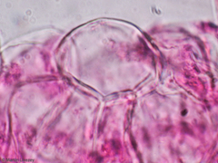 Multifurca ochricompacta