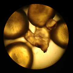 Stigmatella