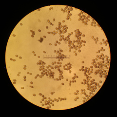 Sphaerosporium lignatile