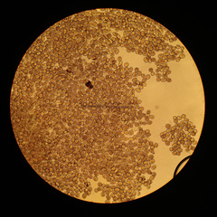 Sphaerosporium lignatile