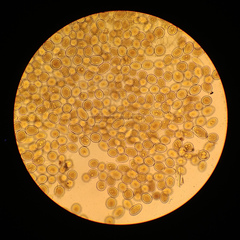 Sphaerosporium lignatile