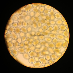 Sphaerosporium lignatile