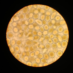 Sphaerosporium lignatile