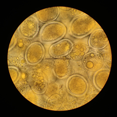 Sphaerosporium lignatile