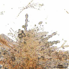 Octospora itzerottii