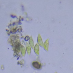 Scenedesmaceae