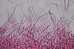 Hypomyces tubariicola