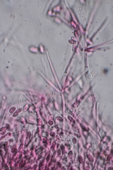 Hypomyces tubariicola