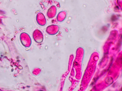 Craterellus calyculus