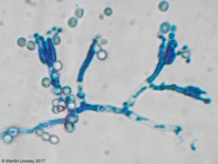 Aspergillus