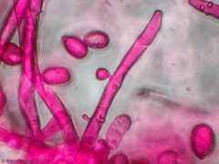 Agaricomycetes
