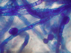 Agaricomycetes