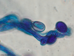 Agaricomycetes