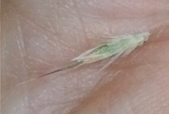 Rytidosperma lepidopodum