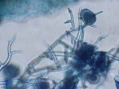 Peronospora belbahrii