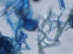 Peronospora belbahrii