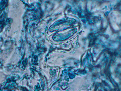 Peronospora belbahrii