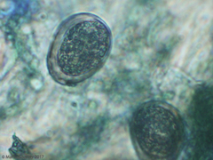Peronospora belbahrii