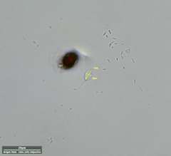 Euglenozoa