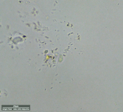Euglenozoa