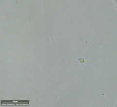 Euglenozoa