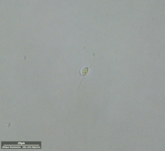 Euglenozoa