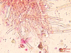 Crustoderma corneum