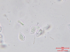 Crustoderma corneum