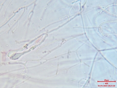 Myxarium nucleatum