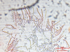 Hypomyces rosellus