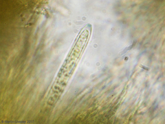 Bispora